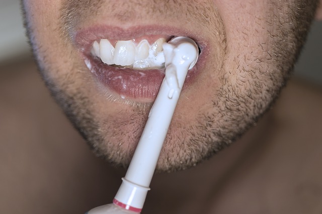 מה המחיר להלבנת שיניים